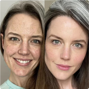 Glov beauty Infusionssystem